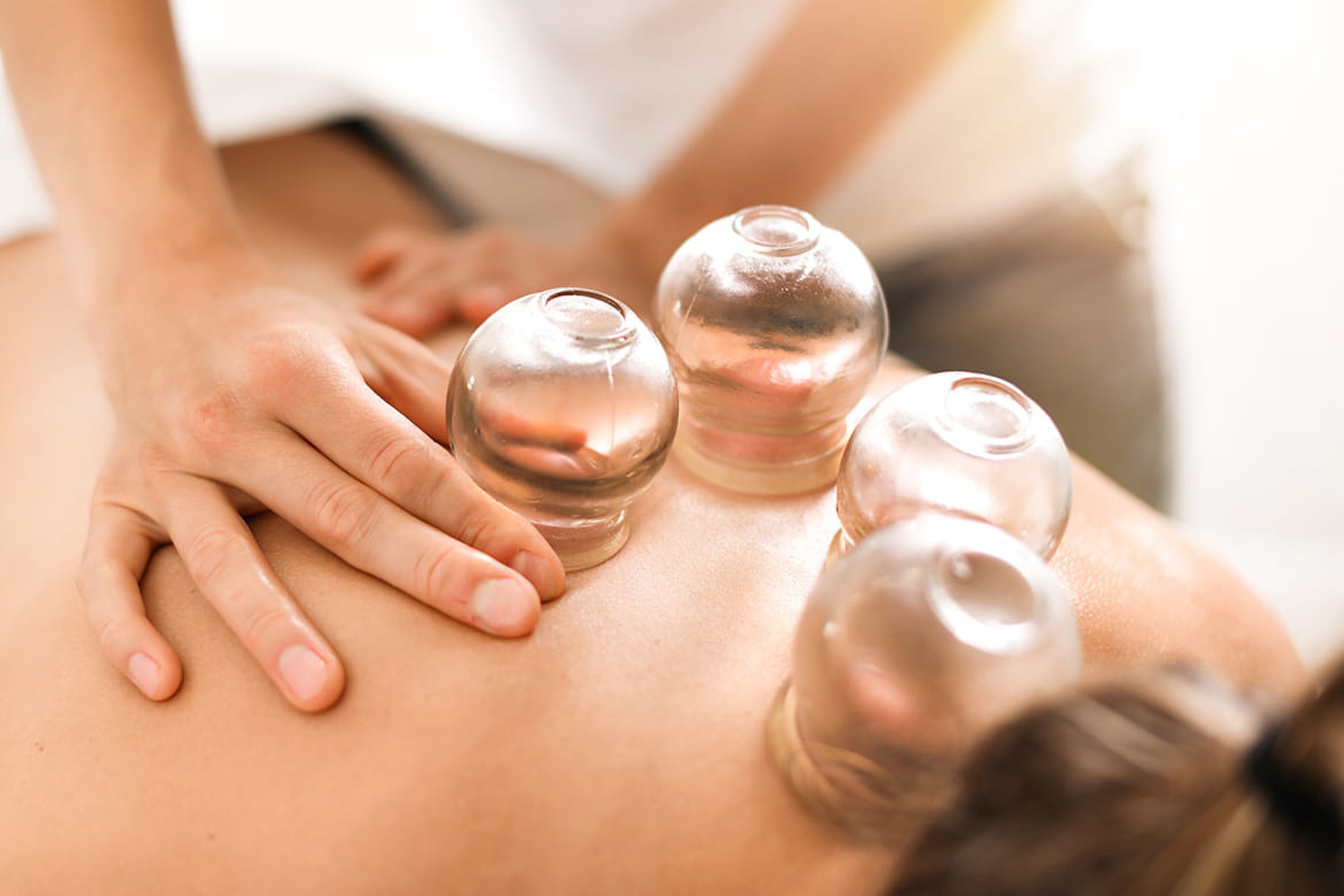 is cupping therapy safe? Guidelines for ensuring safety
