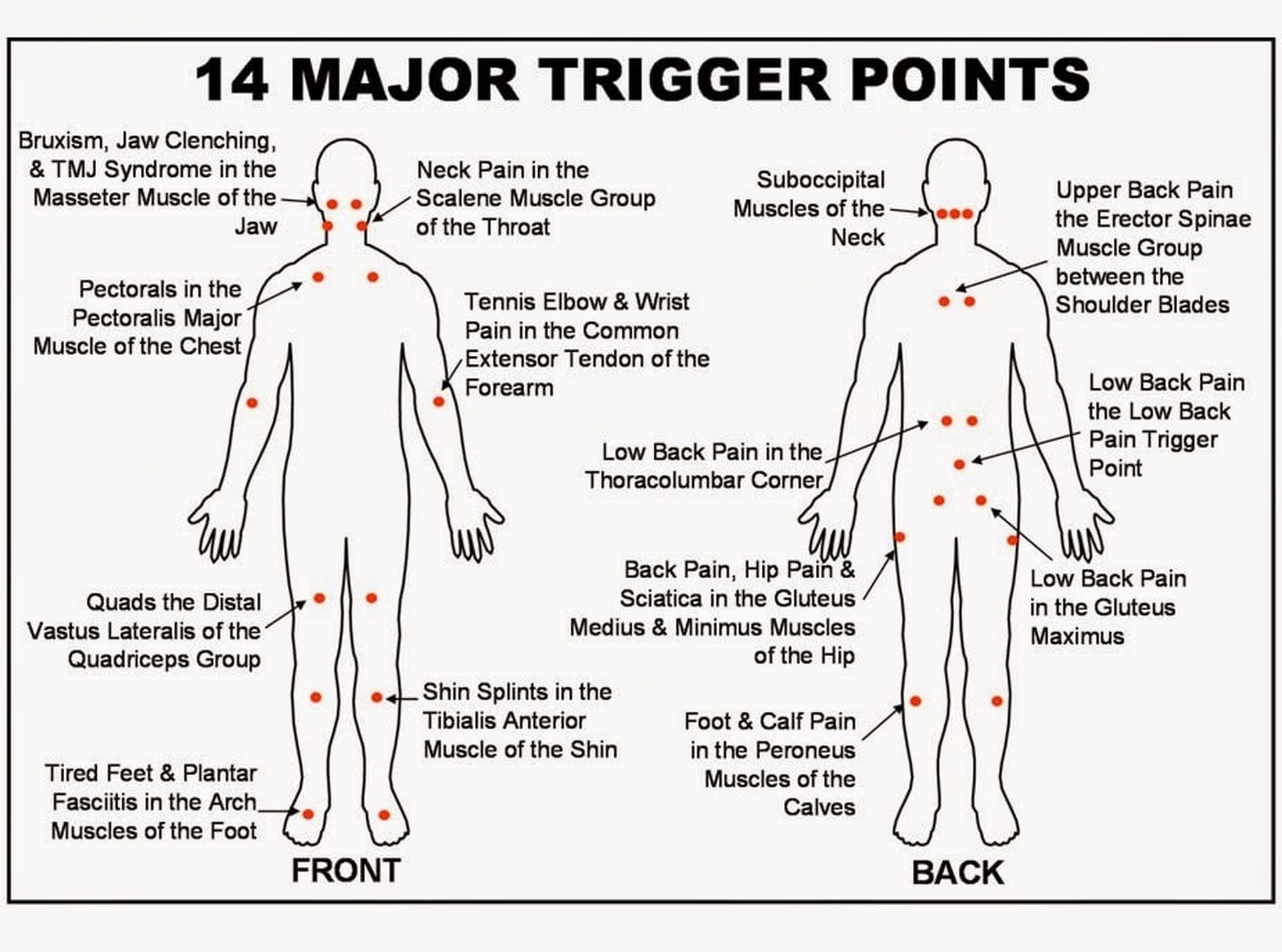 the benefits of using a trigger point dry needling chart