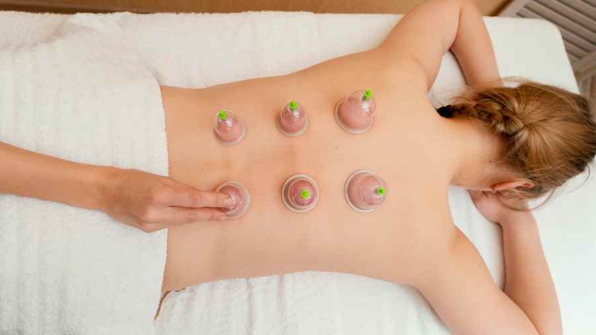 what to do after cupping therapy key recommendations