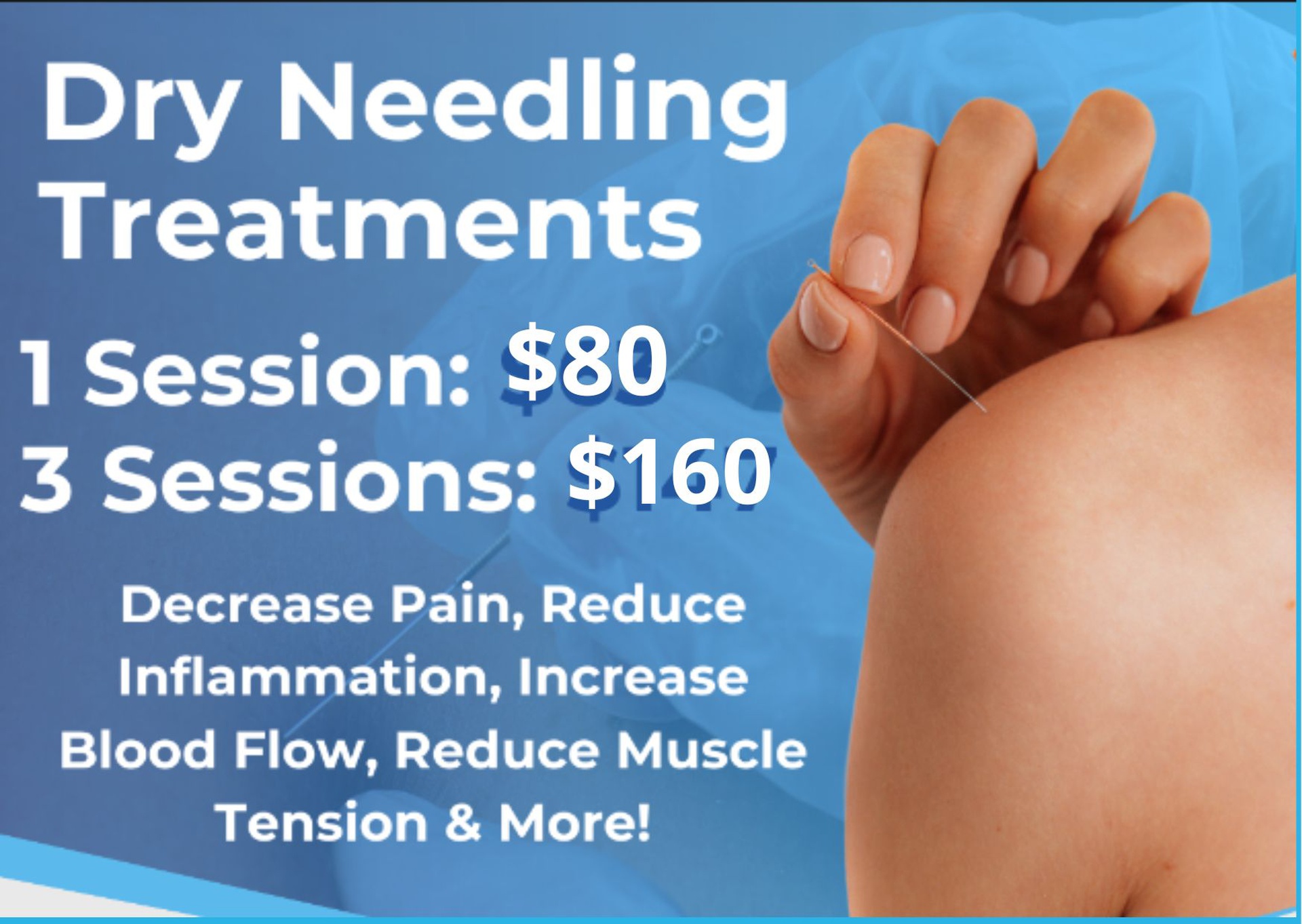 how much does  dry needling cost a comprehensive guide