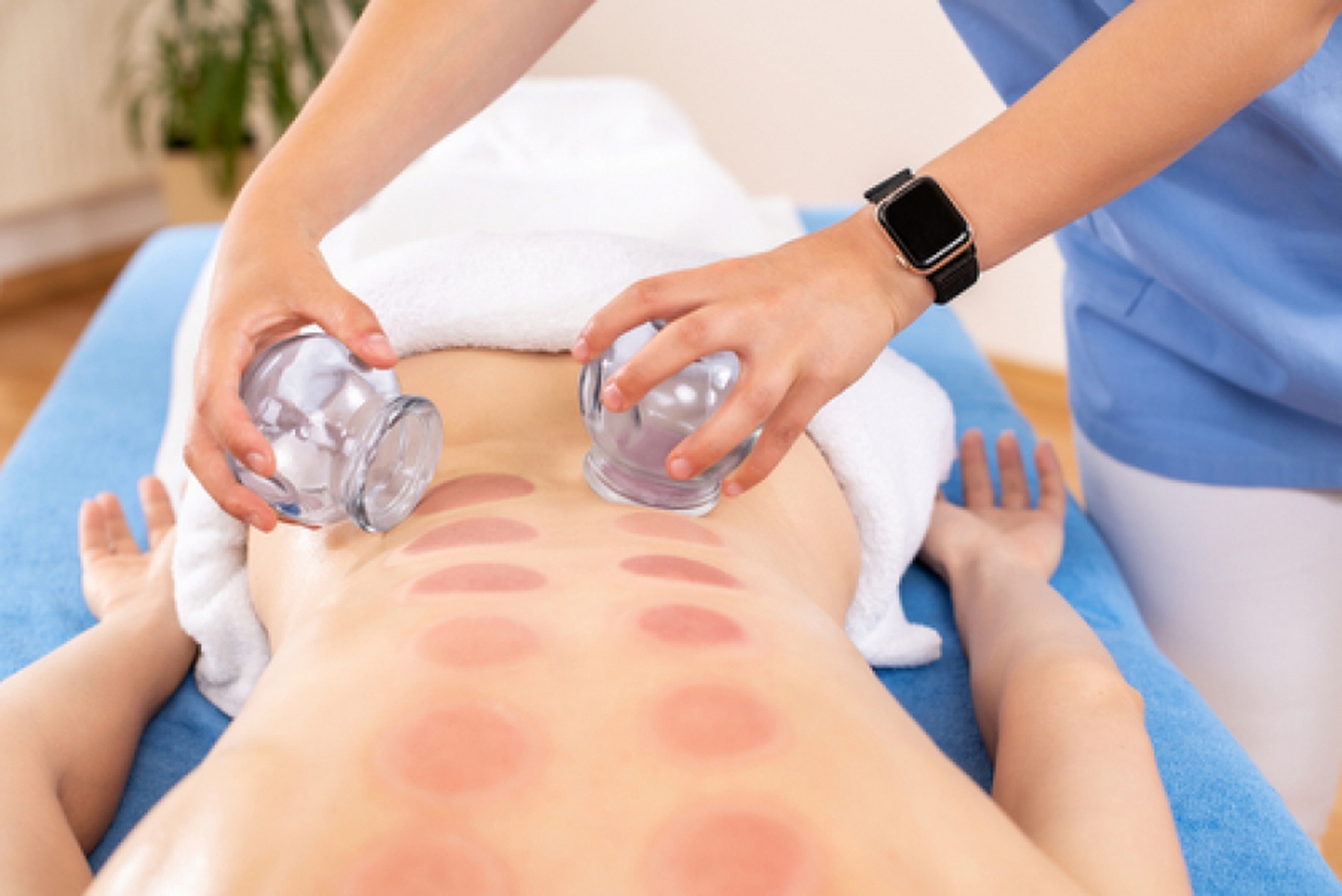 how often can you do cupping therapy an overview