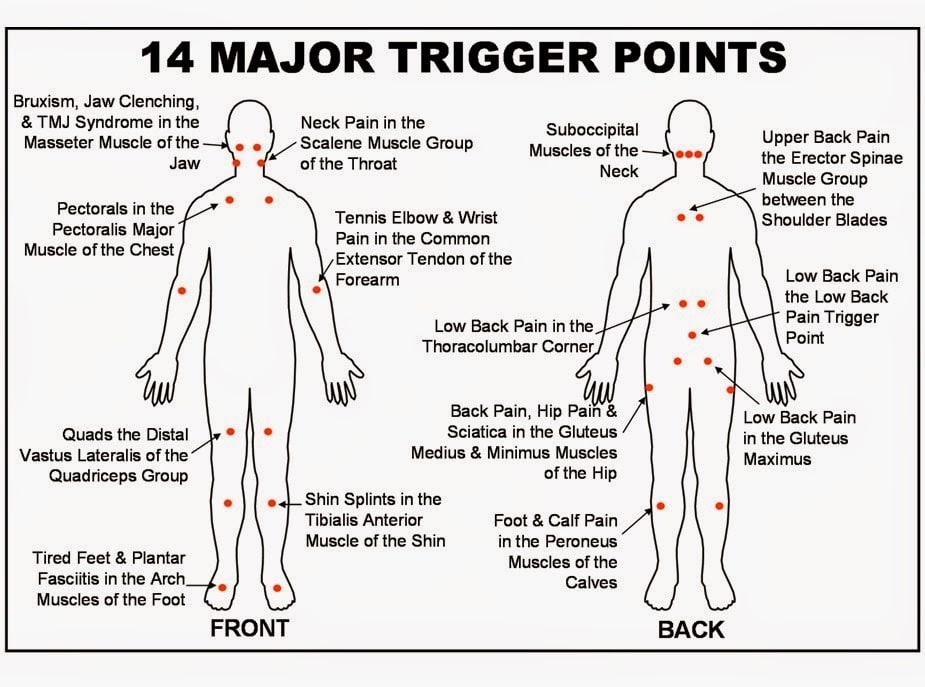 advantages-of-utilizing-trigger-point-dry-needling-chart