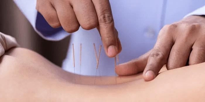 pros-and-cons-of-dry-needling-why-you-should-know 2
