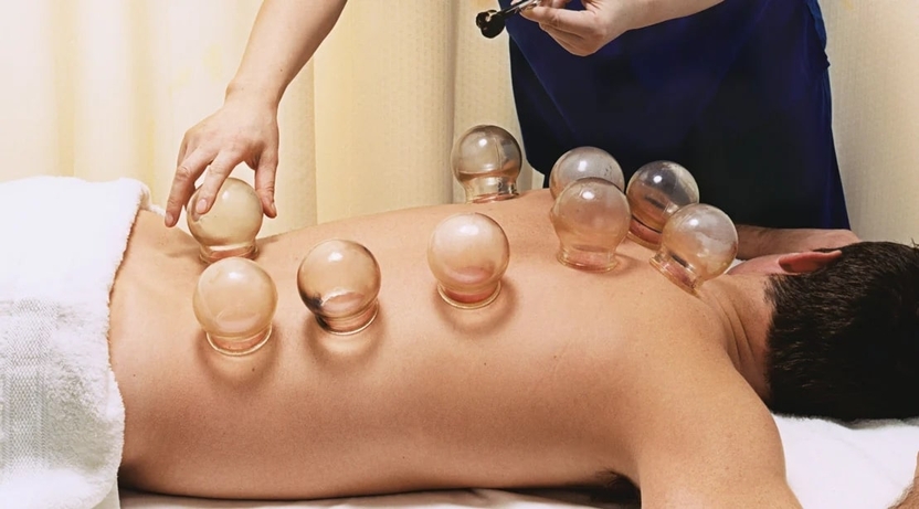what-are-the-benefits-of-cupping-3