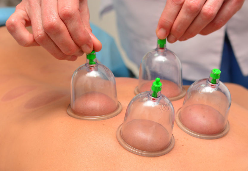 can you take a shower after cupping therapy?avoid doing this 2