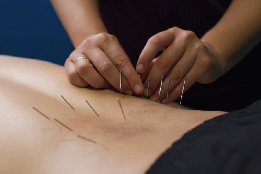 will dry needling help lower back pain the right answer 2