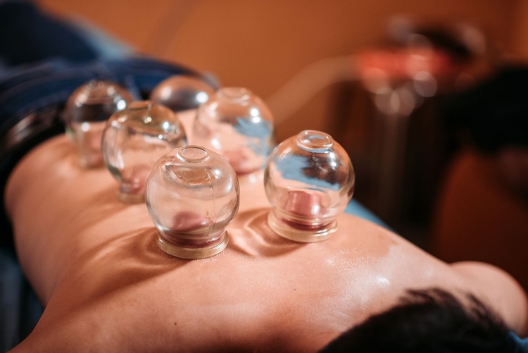 what is cupping therapy good for interested facts 2