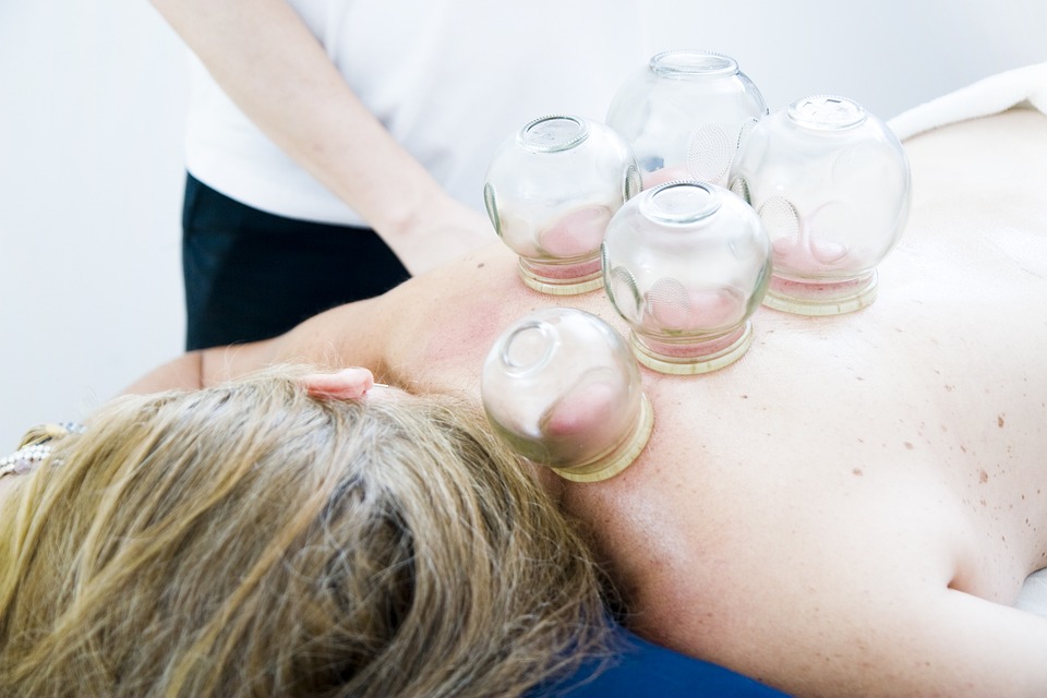 is cupping therapy painful key factors to evaluate 3